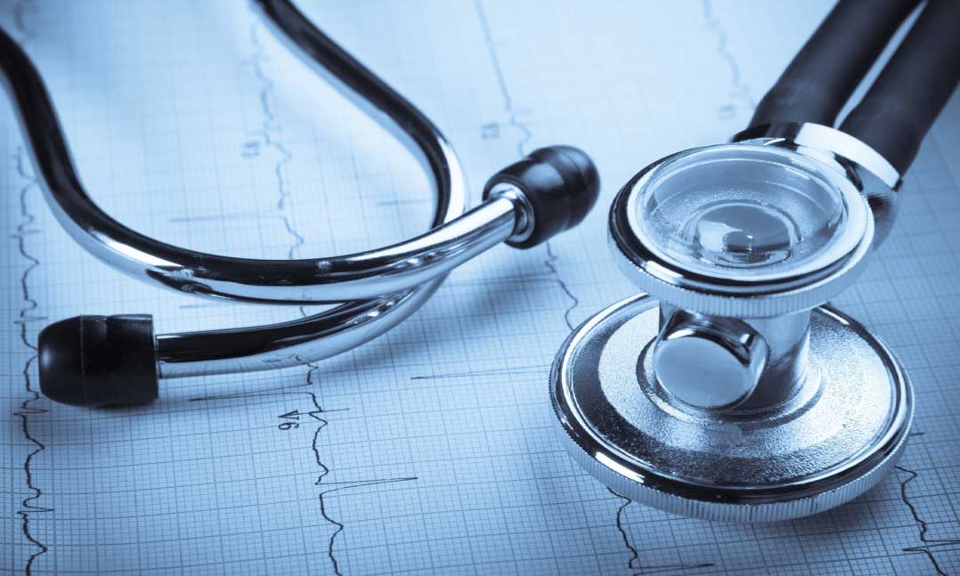 Stethoscope sitting on top of EKG results